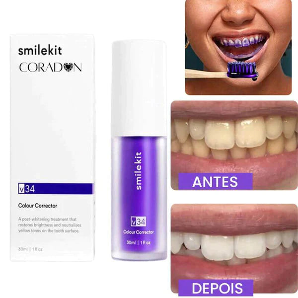 SmileEase V34 - Clareador Mágico Dental | Transforme seu sorriso em poucos dias